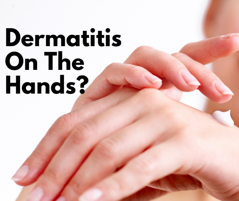 Dermatitis on The Hands